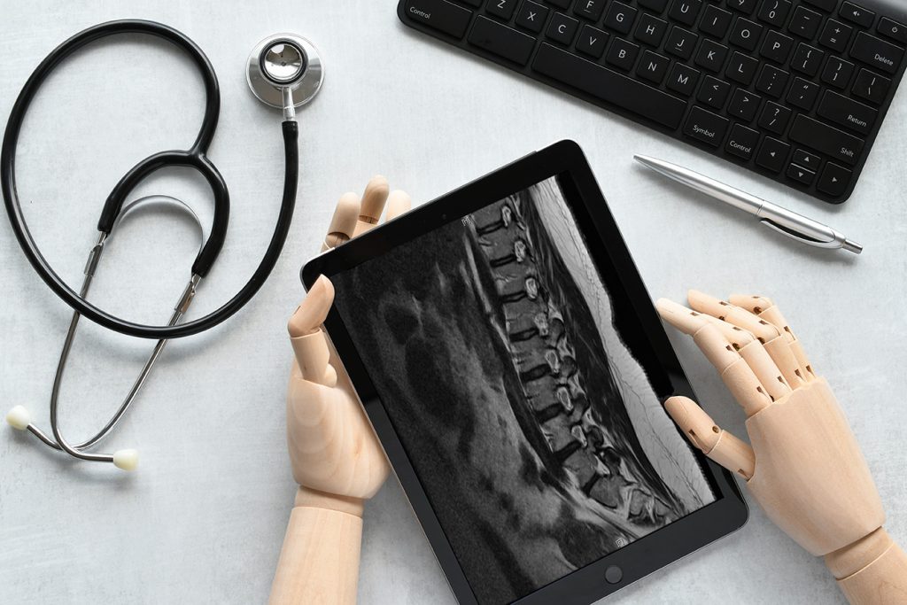 IA et les médecins